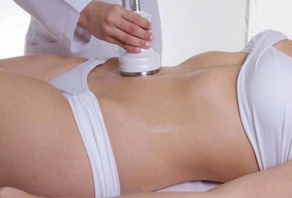 1 Sesión de Cavitador Abdomen: Tratamiento Reductor Efectivo