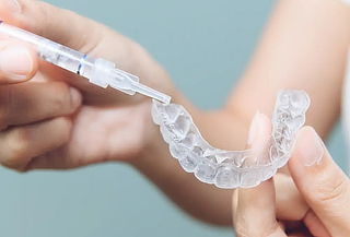 Férula de Blanqueamiento + Profilaxis + Consulta y más
