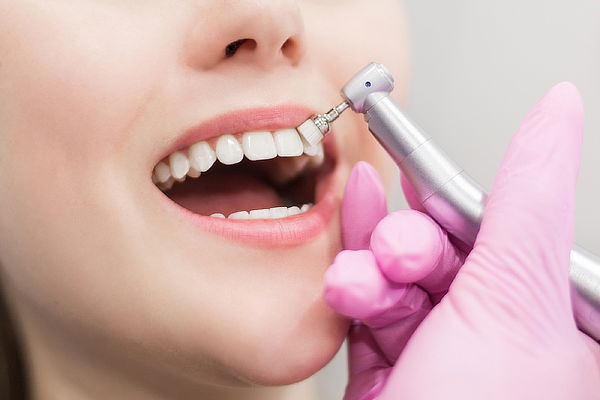 Consulta Odontológica + Profilaxis + Radiografía Periapical