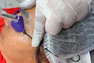 1 Sesión por Remoción de Tatuaje en Cejas en Monas Spa 