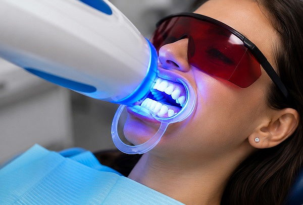 Sesión de Blanqueamiento dental  + Profilaxis