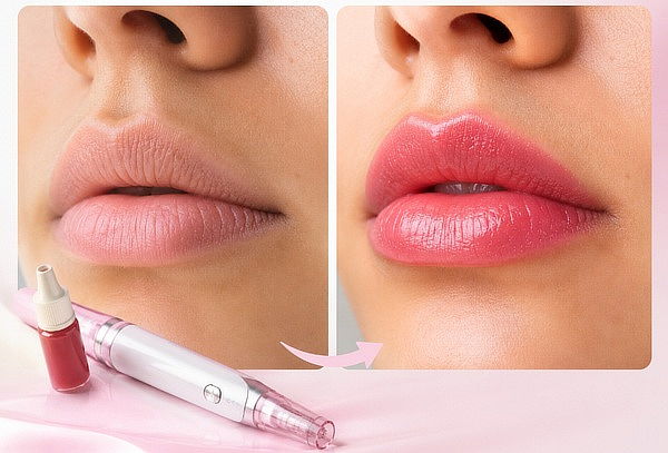 HidraLips con Dermapen