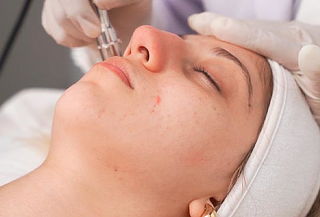 Facial Anti Acné + Máscara LED + Terapia Holística
