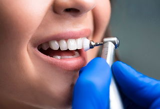 Limpieza Dental Profunda + Destartraje + Profilaxis