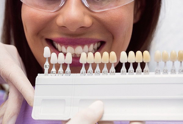 2 Sesiones Blanqueamiento dental + Flúor + Profilaxis