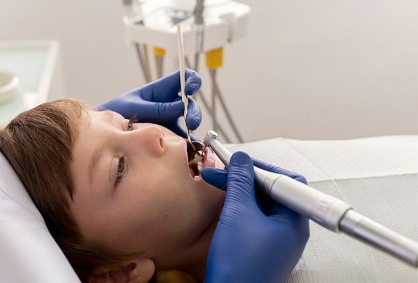 1 Sesión de Aplicación de Barniz Fluorado para Niños