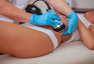 Tratamiento Reductivo Hidrolipoclacia + Carboxiterapia y Más