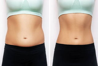 3 Zonas Reduce Hidrolipoclasia + Lipolaser + Ultracavitador