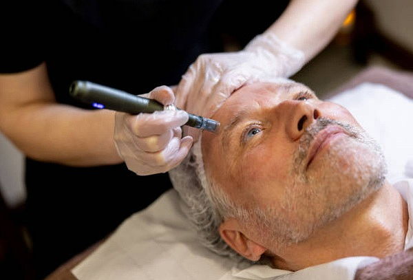 Tratamiento Rejuvenecedor Facial con Exosomas y PDRN