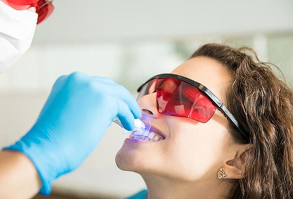 Blanqueamiento LED + Limpieza Dental y Más en D'Laruss