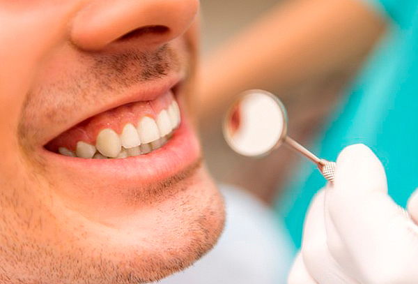 5 Curaciones + Fluorización + Profilaxis y más