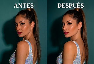 Cuello Definido y Estilizado:Protocolo de Bandas Platismales