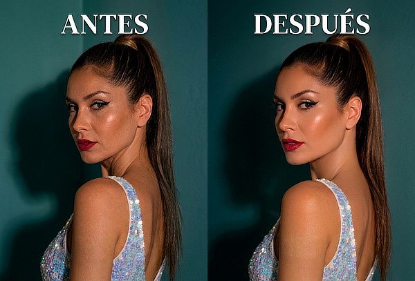 Cuello Definido y Estilizado:Protocolo de Bandas Platismales