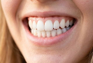 Reparación de cuellos dentales