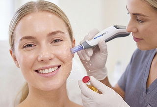 Efecto Porcelana: Dermapen, Pink Glow Vitaminas y Plasma PRP