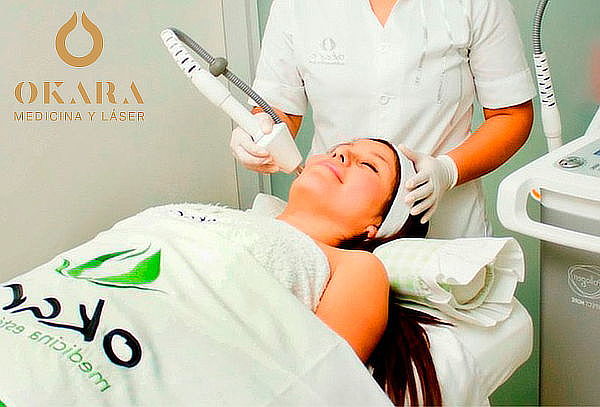 Láser para la Rosácea y Acné en Okara Medicina Estética