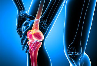 ¡Rodillas Sanas! Tratamiento Desgaste de Meniscos/Ligamentos