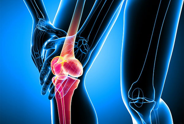 ¡Rodillas Sanas! Tratamiento Desgaste de Meniscos/Ligamentos