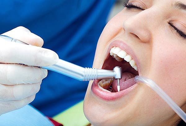 ¡Tus Dientes se Lucirán este Verano! Profilaxis y Más