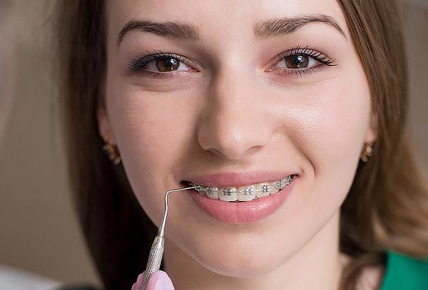 ¡Sonrisa Perfecta! Instalación de Brakets y Más