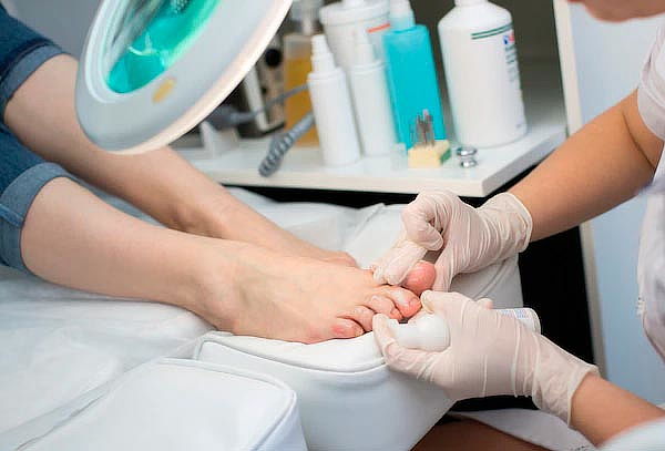 ¡Pies Lindos! 4 o 6 Sesiones de Láser para Hongos y Más