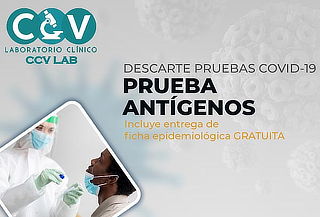 Prueba de Antígeno por Hisopado, para Descarte COVID-19
